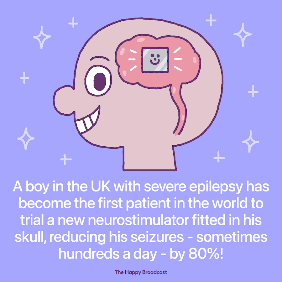 Boy becomes first person fitted with brain implant to control epileptic seizures