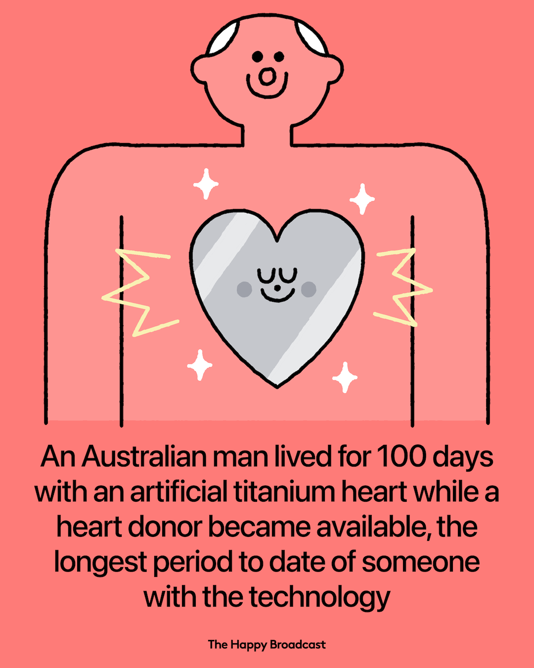 Man Survives with Titanium Heart for 100 Days